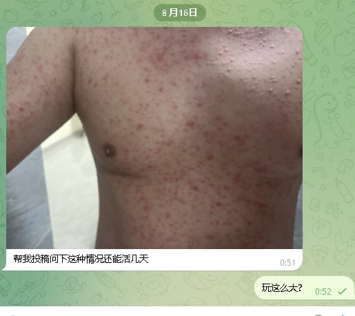 #网友投稿：前一个月在西港找了个按摩妹，想着便宜就去了。自己也有一段时间没碰女人了，一时兴起没戴套，结果最近身上开始陆陆…