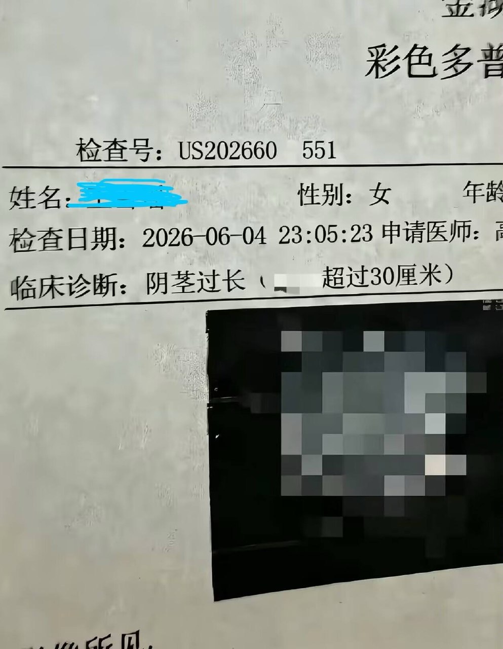 看了半天没懂  性别女？30厘米？