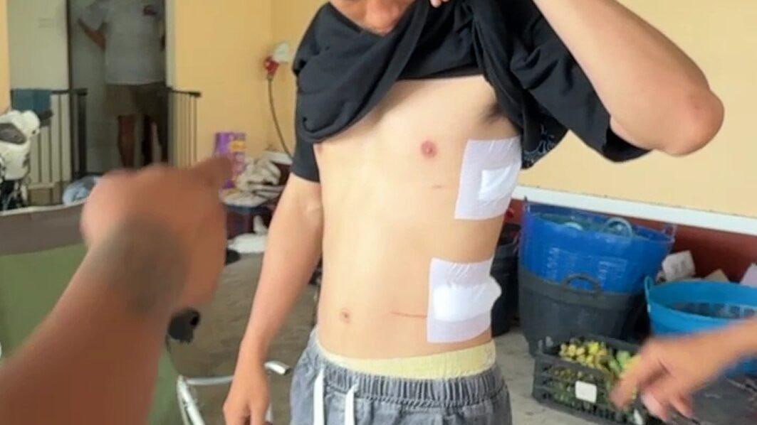 #泰国 北柳府男子出面劝解停车纠纷，无辜遭女子持刀两处刺伤拒绝私了