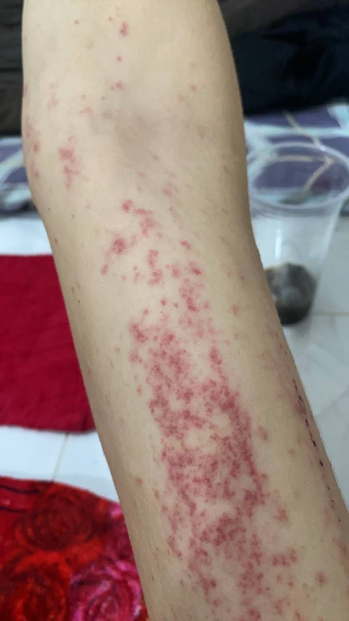 #群友投稿：柬埔寨第三安置点，根本没有把我们当成人对待