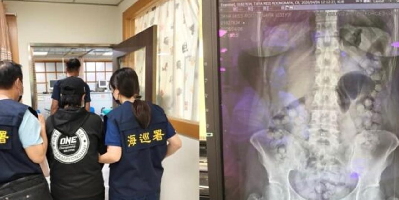 #泰国 泰籍女泰拳教练体内藏72粒海洛因走私入台，遭警方拦截，耗时10天全部排出毒品